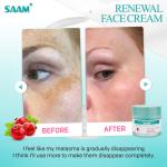 SAAM Renewal Face Cream 50g for Melasma and Freckles Treatment