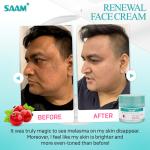 SAAM Renewal Face Cream 50g for Melasma and Freckles Treatment